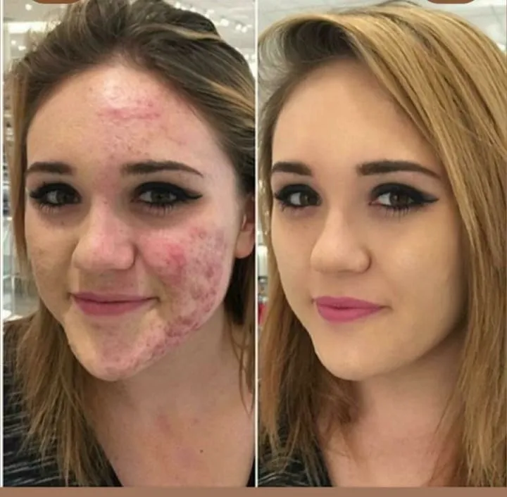 PDNR DNA DE SALMÂO - Foto 4